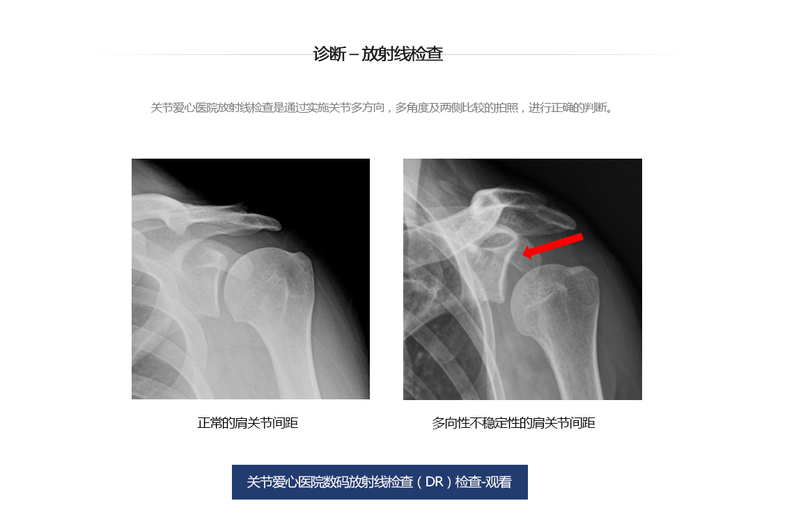 다방향성 불안정성